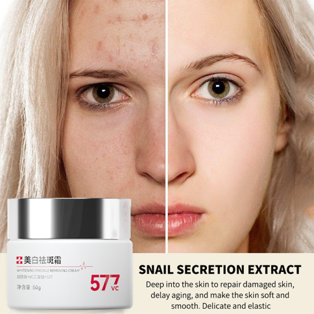 Whitening cream for freckles