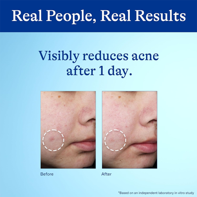 GINSENG HERBAL ACNE CREAM - Image 5