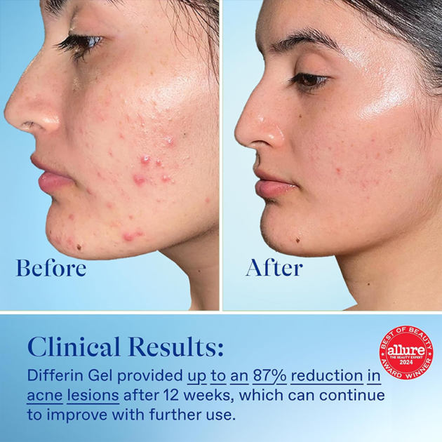GINSENG HERBAL ACNE CREAM - Image 4
