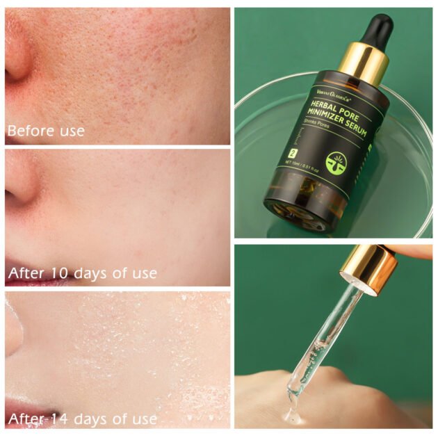 Pore-narrowing serum - Image 4
